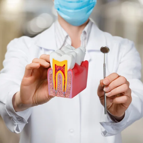 Root canal treatment