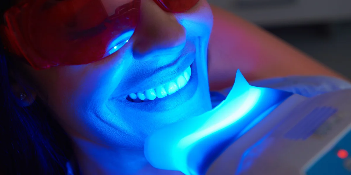 Teeth Whitening Banner